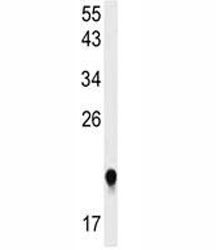 Western blot analysis of IMP3 antibody and HeLa lysate. Predicted molecular weight ~21 kDa.