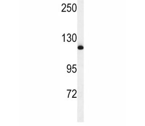 Western blot analysis of NEDD4 antibody and mouse NIH3T3 lysate. Predicted molecular weight ~149 kDa; commonly observed at 110-149 kDa with a possible ~95 kDa cleavage band.