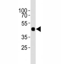 Western blot analysis of lysate from 12 tagged recombinant protein cell lines using HA antibody diluted at 1:1000.