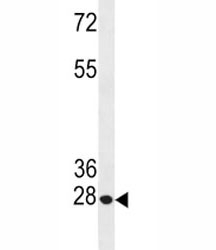 Anti-Bcl-2 antibody western blot analysis in HeLa lysate