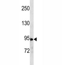 Anti-STAT3 antibody western blot analysis in A431 lysate. Predicted molecular weight ~88kDa.