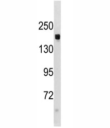 TSC1 antibody western blot analysis in mouse liver tissue lysate. Expected/observed molecular weight: 130~150kDa.