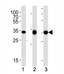 CCND1 antibody western blot analysis in (1) human A431, (2) mouse L929 and (3) rat C6 lysate. Predicted molecular weight: 32-36 kDa.