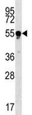 TUBB4Q antibody western blot analysis in Jurkat lysate.