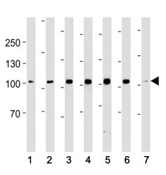 ACE2 antibody western blot analysis in (1) 293, (2) K562, (3) MCF-7, (4) SK-BR-3, (5) T47D, (6) MDA-MB-453 cell line and (7) mouse testis tissue lysate. Predicted molecular weight: 90-100 kDa.