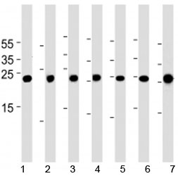 Cebpd antibody western blot analysis in 1) A549, 2) HeLa, 3) NCI-H460, 4) U-937, 5) mouse NIH3T3 cell line, rat 6) lung and 7) testis tissue lysate.