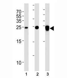 UCHL1 antibody western blot analysis in (1) 293T, (2) NCI-H1299 and (3) rat PC-12 lysate. Predicted molecular weight ~25 kDa.