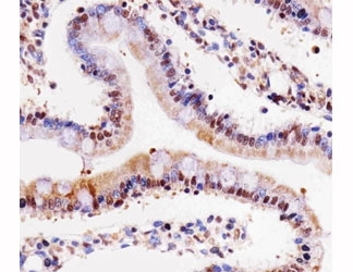 IHC testing of paraffin-embedded rat small intestine using Cdk4 antibody at 1:25.