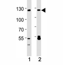 Western blot analysis of lysate from A549, 293 cell line (left to right) using SIRT-1 antibody; Ab was diluted at 1:1000 for each lane. Visualized from 80~120 kDa depending on post-translational modifications
