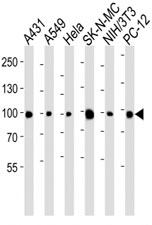 Western blot analysis of lysate from A431, A549, HeLa, SK-N-MC, mouse NIH3T3, rat PC-12 cell line using anti-HSP90 antibody diluted at 1:1000 for each lane.