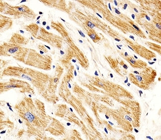 IHC analysis of FFPE human heart section using SMAD1 antibody; Ab was diluted at 1:25.