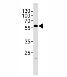Western blot analysis of lysate from mouse testis tissue lysate using PHF1 antibody at 1:1000.