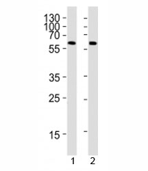 Western blot analysis of 1) human placenta and 2) mouse heart tissue lysate using PPARG antibody at 1:1000. Predicted molecular weight: 54-57 kDa.