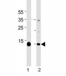 Western blot analysis of lysate from mouse 1) heart and 2) skeletal muscle tissue lysate using Myoglobin antibody at 1:1000 for each lane. Predicted molecular weight ~17 kDa.