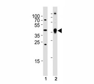 Western blot analysis of (1) zebrafish brain and (2) whole zebrafish tissue lysate using Ada antibody. Ab was diluted at 1:1000 for each lane.