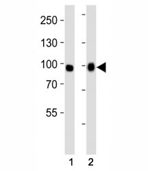 Western blot analysis of lysate from (1) A549 and (2) HeLa cell line using FGFR3 antibody at 1:1000. Predicted molecular weight: 87-135 kDa depending on glycosylation level.