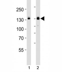 Western blot analysis of lysate from HT-29 cell line and mouse spleen tissue lysate (left to right) using JAK1 antibody; Ab was diluted at 1:1000 for each lane.