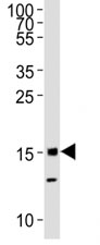 Western blot analysis of lysate from mouse C2C12 cell line using Histone H3 antibody diluted at 1:1000.