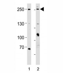 Western blot analysis of lysate from 1) HeLa and 2) MCF-7 cell line using MUC4 antibody; Ab was diluted at 1:1000 for each lane.