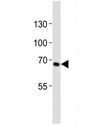 Western blot analysis of lysate from HeLa cell line using CD30 antibody diluted at 1:1000. Predicted molecular weight: 53-120 kDa depending on glycosylation level.