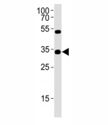 Western blot analysis of lysate from Y79 cell line using OTX2 antibody at 1:1000.