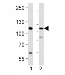 Western blot analysis of lysate from 1) human LNCaP cell line and 2) mouse lung tissue using PRDM16 antibody at 1:1000.