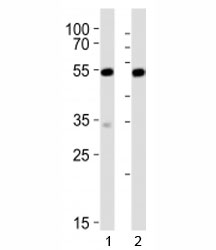 Western blot analysis of lysate from 1) mouse NIH3T3 and 2) rat C6 cell line using Srf antibody at 1:1000. Predicted molecular weight: ~52/60-70kDa (unmodified/phosphorylated).