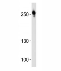 Western blot analysis of lysate from U-87 MG cell line using ROS1 antibody at 1:1000.
