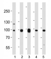 Western blot analysis of lysate from mouse 1) NIH3T3 cell line, 2) brain, 3) heart, 4) pancreas and 5) rat brain tissue lysate using Ephb1 antibody at 1:1000.