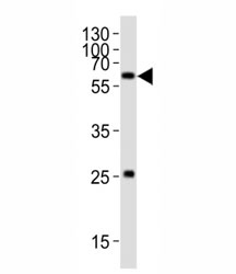 Western blot analysis of lysate from HT-1080 cell line using SMAD1 antibody; Ab was diluted at 1:1000. Predicted molecular weight: 52~60 kDa.