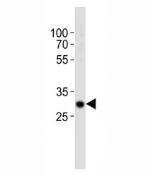 Western blot analysis of lysate from mouse kidney tissue using Hes1 antibody diluted at 1:1000. Predicted molecular weight: 30-35 kDa.