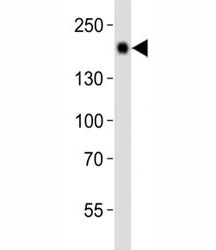 Western blot analysis of lysate from mouse liver tissue using Egfr antibody diluted at 1:1000. Expected molecular weight: ~134/170 kDa (unmodified/glycosylated).