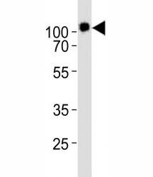 Western blot analysis of lysate from KG-1 cell line using CD34 antibody diluted at 1:1000. Expected size is 40~110 kDa depending on glycosylation level.