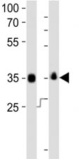 Western blot analysis of lysate from human NCCIT, mouse F9 cell line (left to right) using anti-SOX-2 antibody at 1:1000 for each lane.