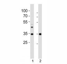 Western blot analysis of lysate from 1) human liver tissue and 2) mouse NIH3T3 cell line using Wdr5 antibody at 1:1000. Predicted molecular weight ~36 kDa.