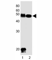 Western blot testing of DLK1 antibody at 1:1000 dilution. Lane 1: human placenta lysate; 2: mouse skeletal muscle lysate; Observed molecular weight 41~60 kDa depending on glycosylation level.