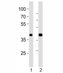 Western blot analysis of lysate from 1) mouse pancreas and 2) rat pancreas tissue using PDX1 antibody at 1:1000. Observed molecular weight 31/40~46kDa (unmodified/modified).