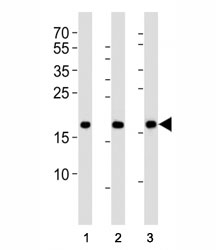 Western blot analysis of lysate from HepG2, NCCIT, mouse NIH3T3 cell line (left to right) using HMGA2 antibody; Ab was diluted at 1:1000 for each lane. Predicted molecular weight ~12kDa but routinely observed at ~18kDa.