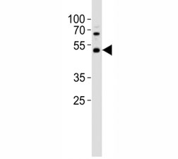 Western blot analysis of lysate from HepG2 cell line using PAX6 antibody; Ab was diluted at 1:1000. Predicted molecular weight ~48kDa.