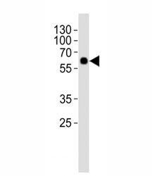 Western blot analysis of lysate from rat lung tissue using SMAD1 antibody at 1:1000. Predicted molecular weight: 52~60 kDa.