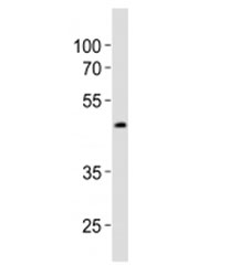 Western blot analysis of lysate from LNCaP cell line using Sox17 antibody diluted at 1:1000. Predicted molecular weight ~45 kDa