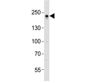 Western blot analysis of lysate from A431 cell line using ZO1 antibody diluted at 1:1000.