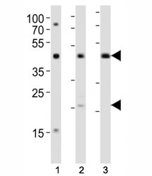 Western blot analysis of lysate from (1) K562, (2) L929 cell line and (3) rat lung tissue using TGFB1 antibody diluted at 1:1000. Predicted molecular weight: 44-50 kDa (precursor), ~25 kDa (active form).