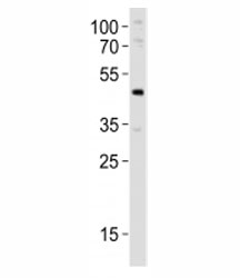 Western blot analysis of lysate from mouse pancreas tissue lysate using Pdx1 antibody at 1:1000. Observed molecular weight 31/40~46kDa (unmodified/modified).