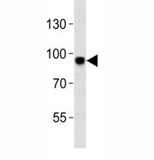 Western blot analysis of lysate from mouse NIH3T3 cell line using Sirt1 antibody at 1:1000. Visualized from 80~120 kDa depending on post-translational modifications