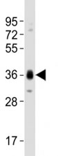 Western blot testing of SOX2 antibody at 1:1000 dilution + NCCIT lysate