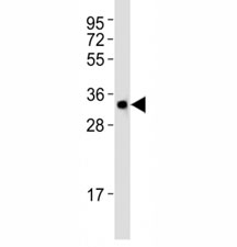 Western blot testing of Atg5 antibody at 1:1000 dilution + HT-1080 lysate. ATG5: ~32 kDA; ATG5/ATG12 heterodimer: ~56 kDa