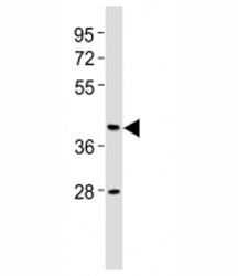 Western blot testing of CB2 antibody at 1:2000 dilution + human brain lysate. Predicted molecular weight ~38 kDa.