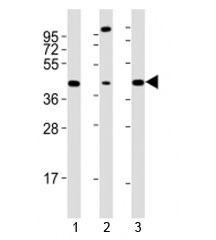 Western blot testing of Sox17 antibody at 1:2000 dilution. Lane 1: mouse F9 lysate; 2: human LNCaP lysate; 3: mouse testis lysate; Predicted molecular weight ~45 kDa.