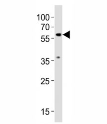 Western blot testing of SMAD2 antibody at 1:1000 dilution + NIH3T3 lysate; Predicted molecular weight: 52~60 kDa.